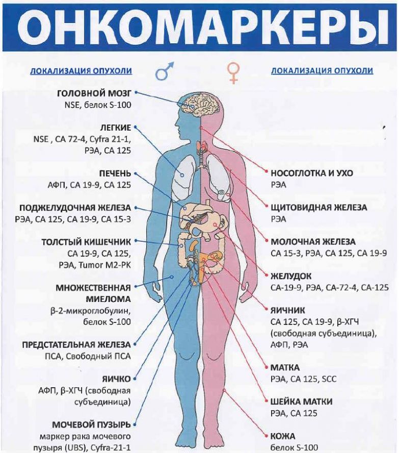 Onkomarkeryi