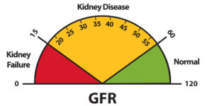 ckd epi