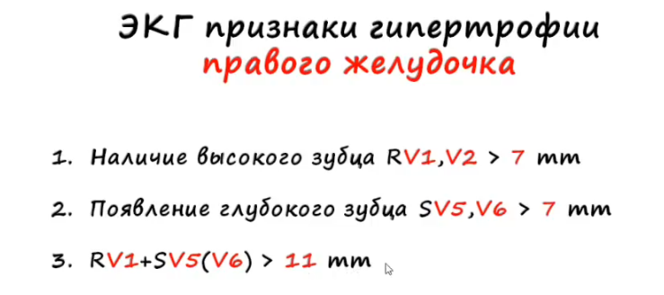 ekg gpzh