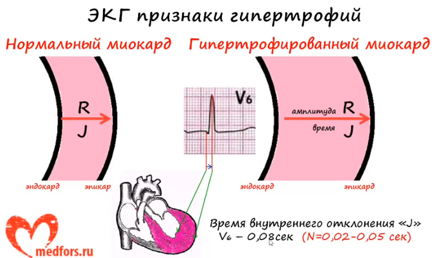 ekgpr
