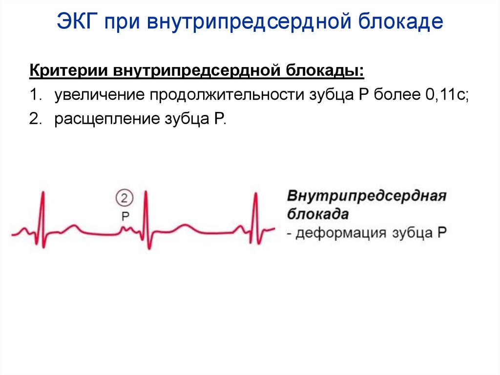 slide 35