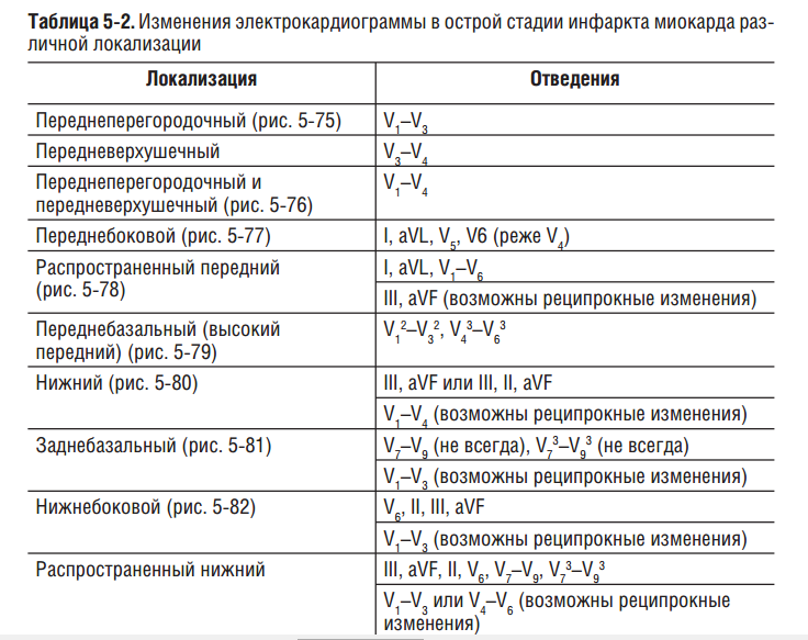 Изменения электрокардиограммы в острой стадии инфаркта миокарда различной локализации