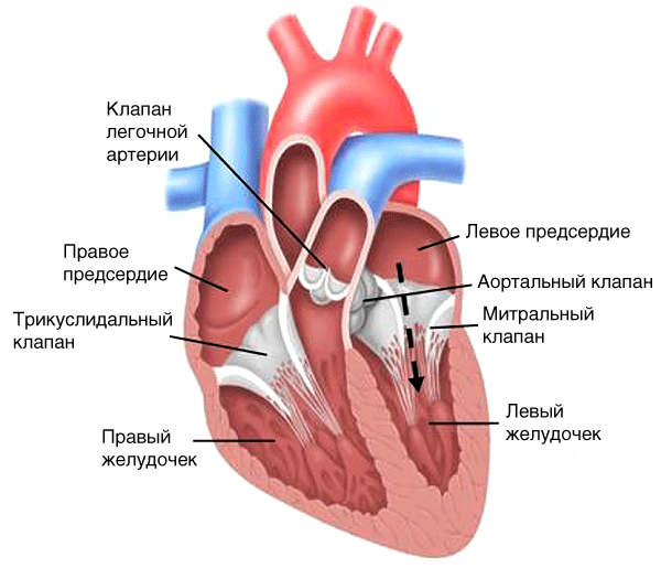 Митральный стеноз