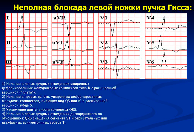 НБЛНПГ
