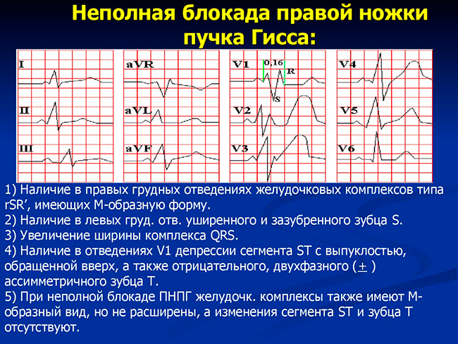 НБПНПГ
