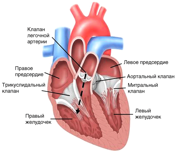 Недостаточность клапана легочной артерии