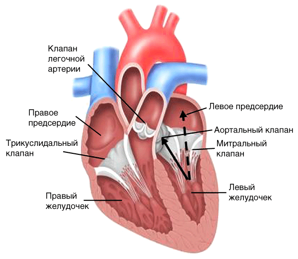 Недостаточность митрального клапана