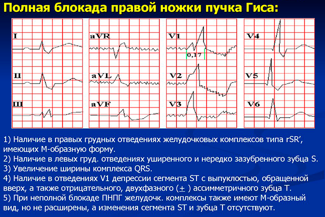ПБПНПГ