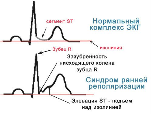 сррж
